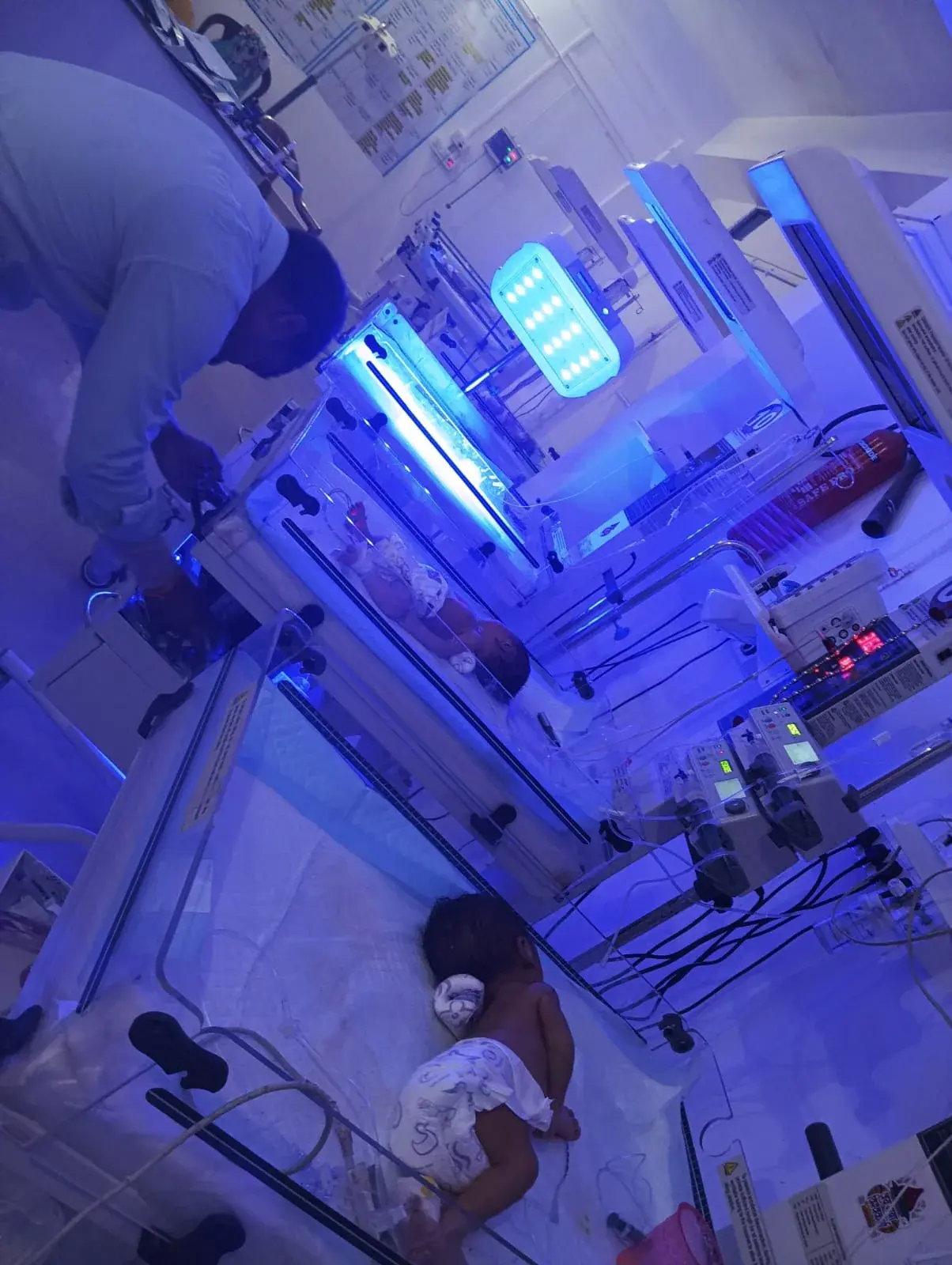 Newborns under phototherapy in the clinic NICU